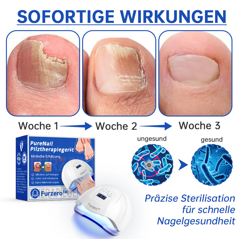 Furzero™ PureNail Pilz-Lasertherapiegerät--