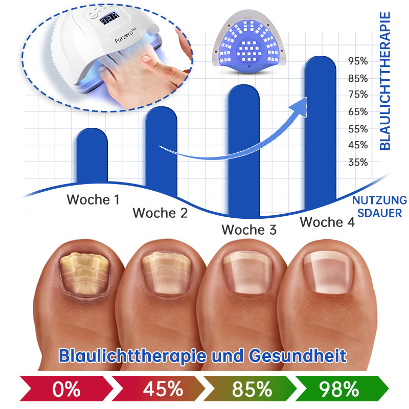 Furzero™ PureNail Pilz-Lasertherapiegerät--