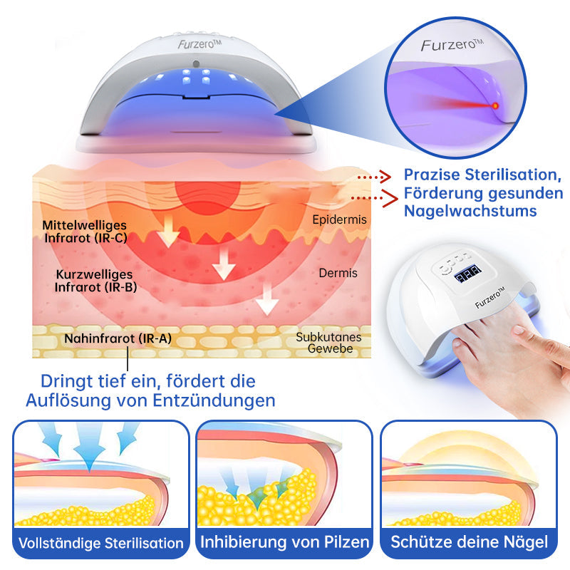 Furzero™ PureNail Pilz-Lasertherapiegerät--