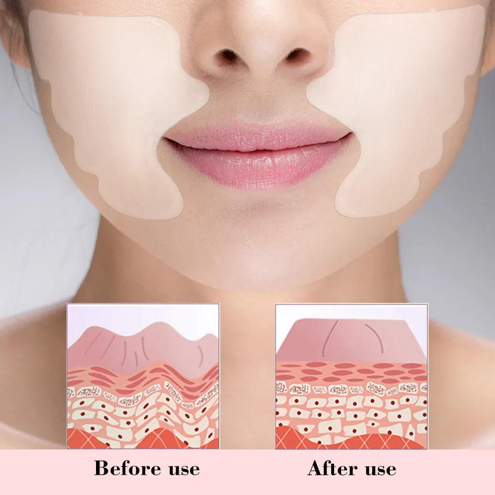 Gesichtsfaltenentferner Pad Wiederverwendbar Medizinisches Silikon Nasolabialfalten Anti-Aging Maske Verhindern Falten Haut Lifting Patches
