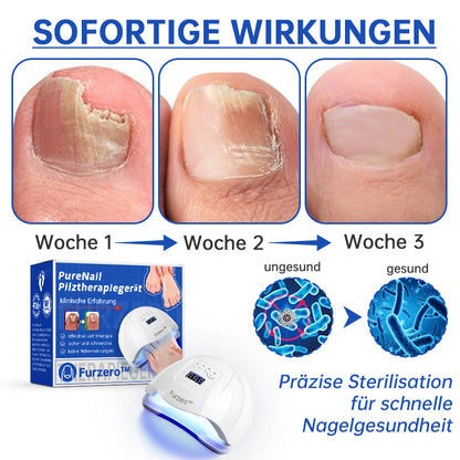 Furzero™ PureNail Pilz-Lasertherapiegerät--