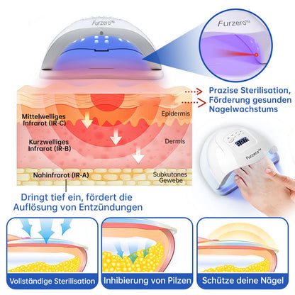 Furzero™ PureNail Pilz-Lasertherapiegerät--